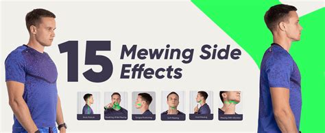 Risks and Side Effects of Improper Mewing: 15 Tips to Avoid Them.